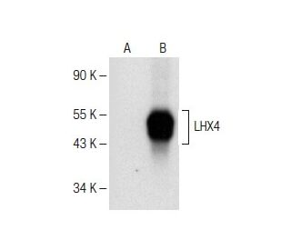 LHX4 Antibody (E-10) - Western Blotting - Image 151275Each CRISPR/Cas9 Knockout (KO) Plasmid product consists of a pool of 3 plasmids designed to ensure identification and cleavage of a specific gene for maximum knockout efficiency. Each plasmid encodes a unique 20 nt sequence derived from the GeCKO (v2) library.