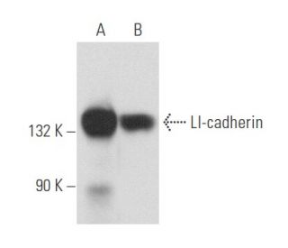 LI-cadherin Antibody (H-1) - Western Blotting - Image 357472 
