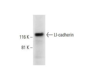 LI-cadherin Antibody (B-1) - Western Blotting - Image 291904Each CRISPR/Cas9 Knockout (KO) Plasmid product consists of a pool of 3 plasmids designed to ensure identification and cleavage of a specific gene for maximum knockout efficiency. Each plasmid encodes a unique 20 nt sequence derived from the GeCKO (v2) library.