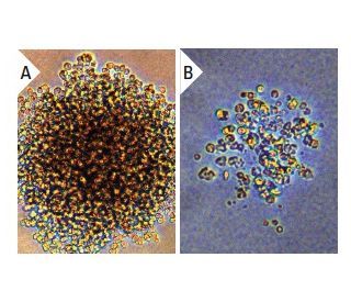 LIF (hBA): sc-4988. Undifferentiated mouse M1 cells cultured for 2 weeks in 0.3% agar medium without LIF (A) and different 