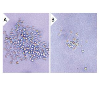 LIF (mBA): sc-4989. Undifferentiated mouse M1 cells cultured for 1 week in 0.3% agar medium without LIF (A) and differenti 