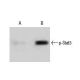 Mouse LIF (sc-4989) induction of Stat3 p91 phosphorylation of Tyr 705 in untreated (A) and LIF-treated (B) 3T3-L1 cells. A