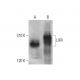 LIFR Antibody (H-7) - Western Blotting - Image 348638
