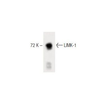 LIMK-1 Antibody (42) - Western Blotting - Image 60350 