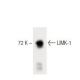 LIMK-1 Antibody (42) - Western Blotting - Image 60350 