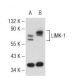 LIMK-1 Antibody (C-10) - Western Blotting - Image 127031