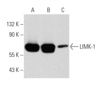 LIMK-1 Antibody (H-12) - Western Blotting - Image 356924