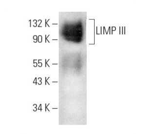 LIMP III Antibody (5A-9) - Western Blotting - Image 3772