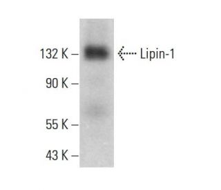 Lipin-1 Antibody (B-12) - Western Blotting - Image 381294The Double Nickase Plasmid features a U6 promoter for sgRNA expression, a 20 nt targeting sequence, and a gRNA scaffold to guide Cas9n. It includes a CBh promoter for Cas9n (D10A) and puromycin resistance, GFP for transfection verification, and nuclear localization signals (NLS). The 2A peptide allows co-expression of Cas9n and Puro from a single promoter, enabling precise genome editing with reduced off-target effects.