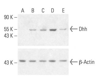 LPS: sc-21855. Western blot analysis of Dhh expression in untreated (A), Pervanadate treated (B), Anisomycin-treated (C),