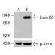 Liprin β2 Antibody (H-6) - Western Blotting - Image 414776 