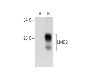 LMO2 Antibody (H-10) - Western Blotting - Image 320936