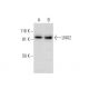 LNX2 Antibody (D-3) - Western Blotting - Image 301498 