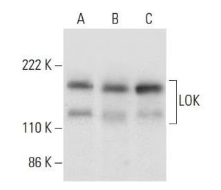 LOK Antibody (D-6) - Western Blotting - Image 300636 