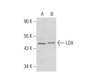 LOX Antibody (F-8) - Western Blotting - Image 306202SAM Transcription Activation: SAM system utilizing dCas9-VP64, MS2-P65-HSF1, and sgRNA for precise gene transcription activation. 