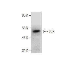 LOX Antibody (B-11) - Western Blotting - Image 331207The Double Nickase Plasmid features a U6 promoter for sgRNA expression, a 20 nt targeting sequence, and a gRNA scaffold to guide Cas9n. It includes a CBh promoter for Cas9n (D10A) and puromycin resistance, GFP for transfection verification, and nuclear localization signals (NLS). The 2A peptide allows co-expression of Cas9n and Puro from a single promoter, enabling precise genome editing with reduced off-target effects. 