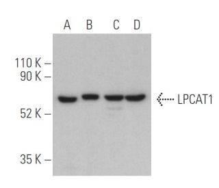 LPCAT1 Antibody (F-9) - Western Blotting - Image 400554