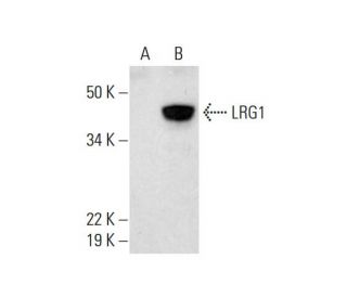 LRG1 Antibody (H-11) - Western Blotting - Image 291867