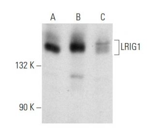 LRIG1 Antibody (B-2) - Western Blotting - Image 357367Each CRISPR/Cas9 Knockout (KO) Plasmid product consists of a pool of 3 plasmids designed to ensure identification and cleavage of a specific gene for maximum knockout efficiency. Each plasmid encodes a unique 20 nt sequence derived from the GeCKO (v2) library.