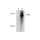 LRP5 Antibody (F-11) - Western Blotting - Image 326491