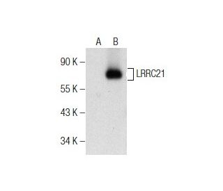 LRRC21 Antibody (F-10) - Western Blotting - Image 155821