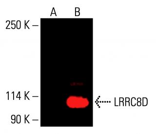 LRRC8D Antibody (A-12) - Western Blotting - Image 416341 