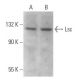 Lsc Antibody (G-7) - Western Blotting - Image 359189 