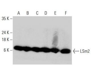 LSm2 Antibody (AT2B2) - Western Blotting - Image 385117 