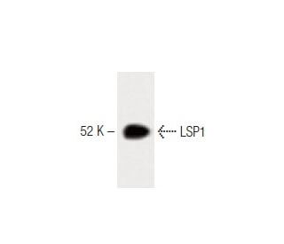 LSP1 Antibody (16) - Western Blotting - Image 60353 