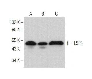 LSP1 Antibody (TDP153) - Western Blotting - Image 377669 