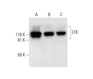 LTK Antibody (B-6) - Western Blotting - Image 295883 