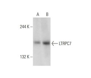 LTRPC7 Antibody (H-4) - Western Blotting - Image 129302Each CRISPR/Cas9 Knockout (KO) Plasmid product consists of a pool of 3 plasmids designed to ensure identification and cleavage of a specific gene for maximum knockout efficiency. Each plasmid encodes a unique 20 nt sequence derived from the GeCKO (v2) library.