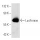 Luciferase Antibody (Luci 21 1-107) - Western Blotting - Image 14976