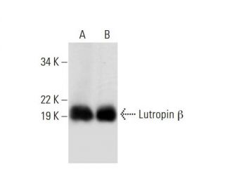 Lutropin &beta; Antibody (A-9) - Western Blotting - Image 294490 