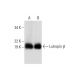 Lutropin β Antibody (A-9) - Western Blotting - Image 294490 