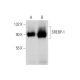 LXR&amp;lpha;/β Agonist: sc-221864. Western blot analysis of SREBP-1 expression in untreated (A) and LXR&amp;lpha;/β Ago