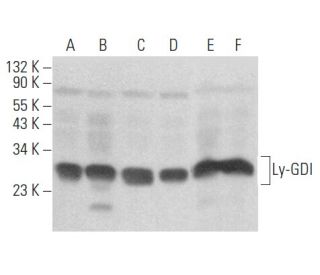 Ly-GDI/RhoGDI2/ARHGDIB Antibody (E-10) - Western Blotting - Image 354462 