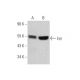 Lyn Antibody (2H8D7) - Western Blotting - Image 353453