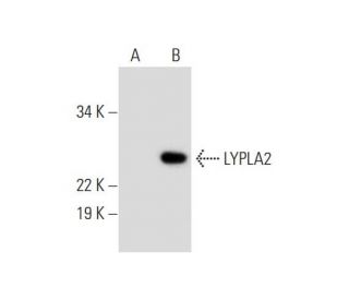 LYPLA2 Antibody (B-12) - Western Blotting - Image 289596