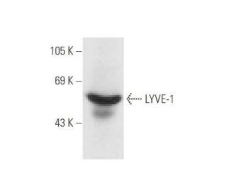 LYVE-1 Antibody (E9VA4) - Western Blotting - Image 62646
