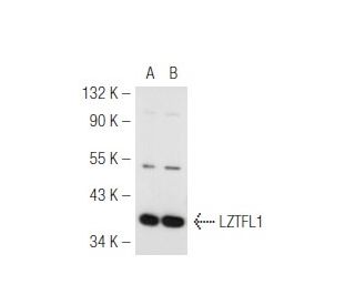 LZTFL1 Antibody (35-Y) - Western Blotting - Image 47983Each CRISPR/Cas9 Knockout (KO) Plasmid product consists of a pool of 3 plasmids designed to ensure identification and cleavage of a specific gene for maximum knockout efficiency. Each plasmid encodes a unique 20 nt sequence derived from the GeCKO (v2) library.