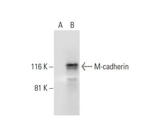 M-cadherin Antibody (C-6) - Western Blotting - Image 289721