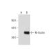 M-ficolin Antibody (036-05-1) - Western Blotting - Image 57388