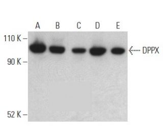 DPPX (A-8): sc-365147. Western blot analysis of DPPX expression in DU 145 (A), IMR-32 (B), Neuro-2A (C), F9 (D) and AT3B-1 