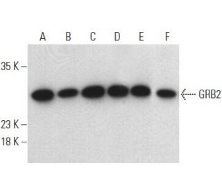GRB2 (E-1): sc-17813. Western blot analysis of GRB2 expression in Jurkat (A), HEK293 (B), Ramos (C), HL-60 (D), MOLT-4 (E) 