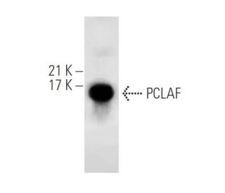 M1 Whole Cell Lysate: sc-364782. Western blot analysis of p15... 