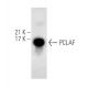 M1 Whole Cell Lysate: sc-364782. Western blot analysis of p15... 