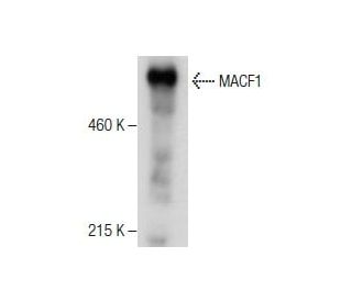 MACF1 Antibody (A-3) - Western Blotting - Image 281135 