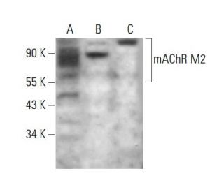 mAChR M2 Antibody (2Q147) - Western Blotting - Image 377247