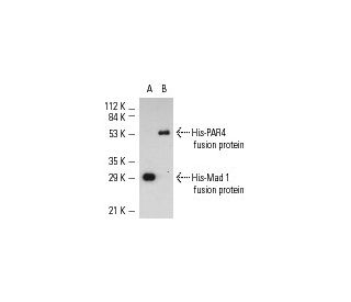 His-probe (H-15): sc-803. Western blot analysis of Mad 1 (1-221):...